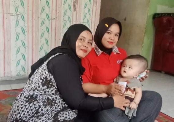 RAS H Novri Ompusunggu Bantu Balita Usia 6 Bulan Penderita Hidrosefalus